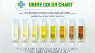 The colour of your urine says a lot about your health