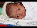 NICU Procedures- Nasogastric and orogastric tube placement