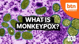 What is Monkeypox and Should You be Worried?