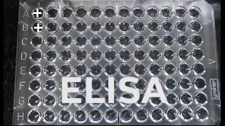 ELISA | How to do ELISA | step by step procedure for ELISA