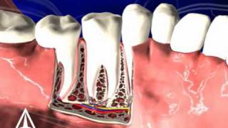 Tooth Anatomy - 3D Medical Animation