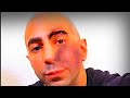 Fouseytube GETS HIS A$$ KNOCKED OUT