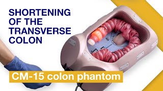 Basic Techniques of Colonoscope Insertion | Exercise 4: Shortening of the transverse colon