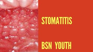 Gastrointestinal disorder .   stomatitis ( part -1 Chap -1) Adult Health Nursing   . .  BSN