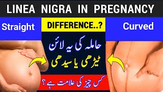 Black Line on Belly During Pregnancy |Linea Nigra |Boy or Girl |Pregnancy Signs |Baby Boy Symptoms