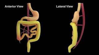 New Revelations in the Pathophysiology and Surgical Management of Congenital Gut Malrotation