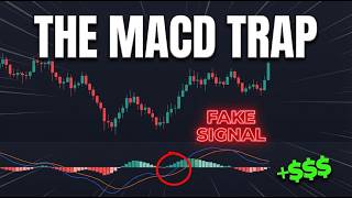 Most Traders Use MACD Wrong — Here's How The Pros Actually Trade It