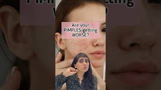 Acne Treatment | Pimple Removal | Acne | Acne Removal #shorts