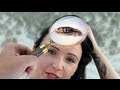 How to Remove Head Lice Eggs - Lice Treatment At Home How to Remove Head Lice Eggs - Lice Treatment At Home