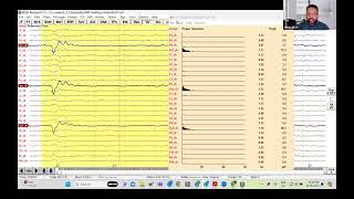 BESA Research Workshop Tutorial 1C: FFT and DSA
