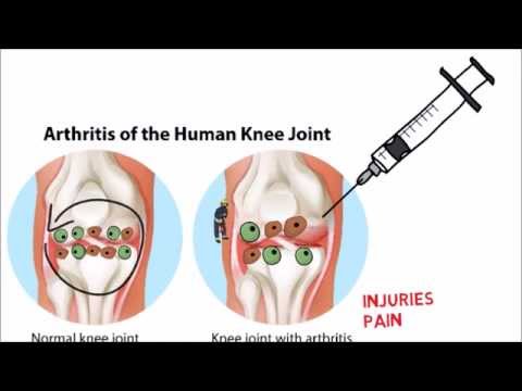 What is stem cell therapy What is stem cell therapy
