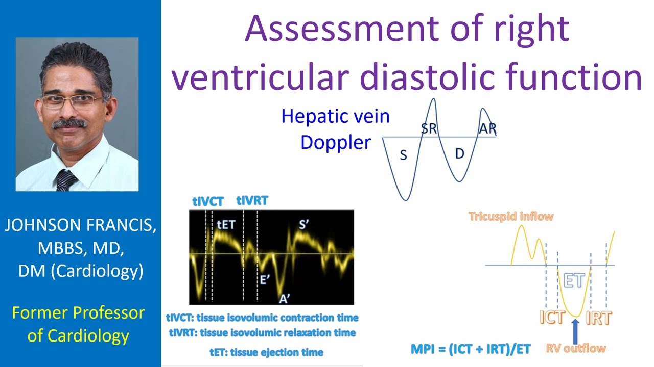 Right Ventricular Dysfunction Guidelines At Jack Black Blog