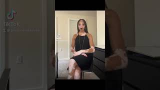Vitiligo Awareness: Embrace Diversity #vitiligo