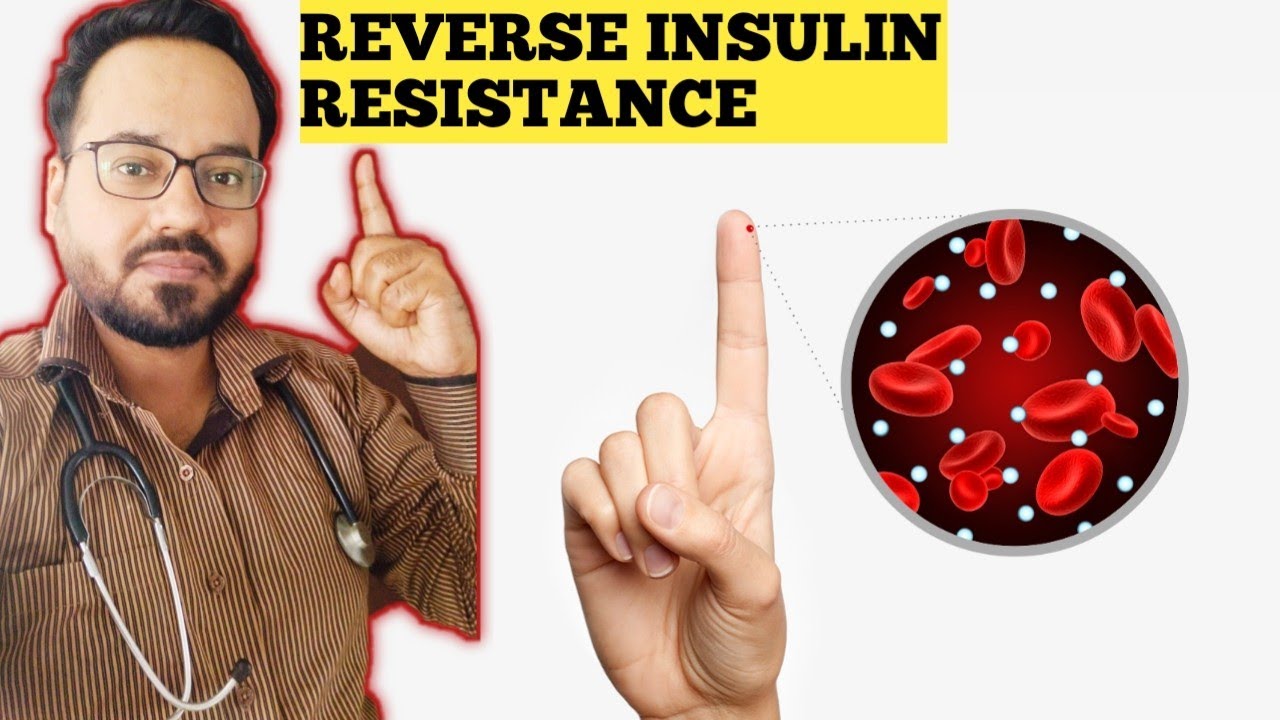 How To Reverse Insulin Resistance Naturally - YouTube