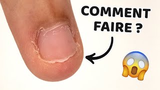 ONGLE RONGÉ  -  RÉUSSIR une EXTENSION CHABLON