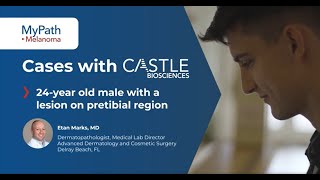 MyPath Test Clarifies Atypical Spitzoid Lesion in Young Adult | Dr. Etan Marks Case Review