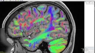 Multi-tissue constrained spherical deconvolution on HCP data