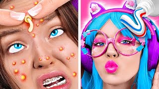 NEVER POP PIMPLES 😮 *Extreme MAKEOVER FROM NERD TO POPULAR STREAMER GIRL*