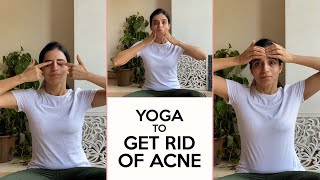 Face Yoga To Get Rid Of Acne | 6 Exercises To Get Clear Skin | Yoga With Mansi | Fit Tak