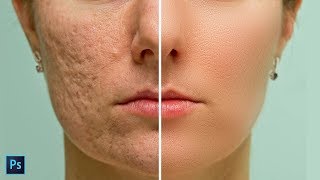High-End Skin Softening in Photoshop - Remove Blemishes, Wrinkles, Acne Easily and Quickly