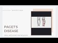 PAGET'S DISEASE