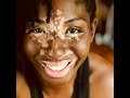 Living Well With Vitiligo - Vitiligo and Professional Identity