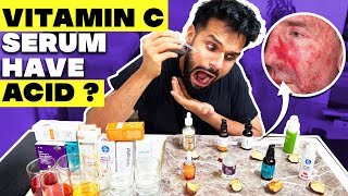 Testing The Best Vitamin C Serum For Indian Skin *Shocking Result* | BeYourBest