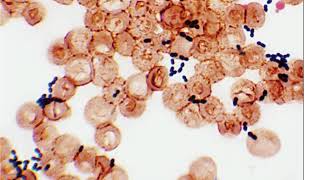 Enterococci Corynebacterium diphtheria Gram positive rods 1