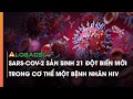 SARS-CoV-2 sản sinh 21 đột biến mới trong cơ thể một bệnh nhân HIV