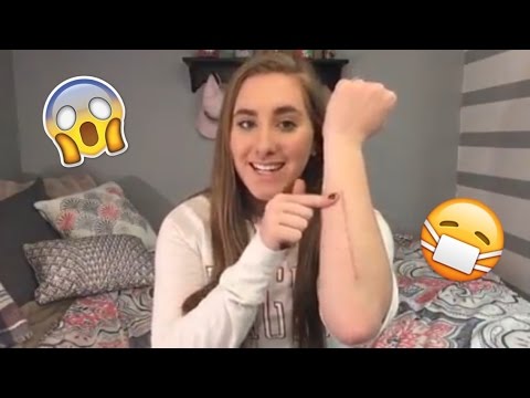 BREAKING MY ARM + ACTUAL FOOTAGE BREAKING MY ARM + ACTUAL FOOTAGE