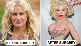 10 Celebrity Plastic Surgery Disasters  [Number 8 Is INSANE!!]