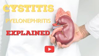 What is Cystitis? | Cystitis Explained