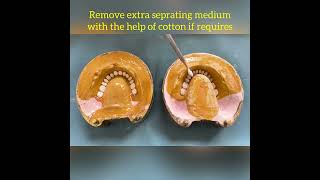Processing of Complete Denture