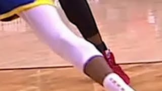 Close up Achilles Injury | Durant