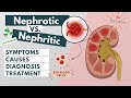 Nephrotic vs. Nephritic syndrome | Symptoms, diagnosis, causes, treatment | Visual explanation