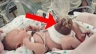 Doctors couldn't stop screaming when they realized how this baby was born