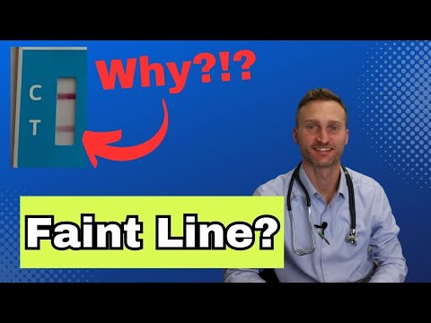 When do we consider a urine sample invalid?