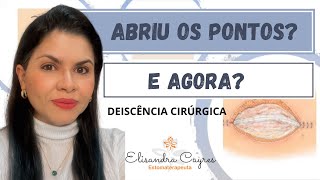 DEISCÊNCIA CIRÚRGICA - ABRIU OS PONTOS E AGORA? ESTOMATERAPIA