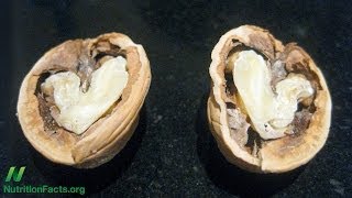 Walnuts and Artery Function