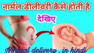Pregnancy Tips | नार्मल डिलीवरी कैसे होती है | Tips For Normal Delivery