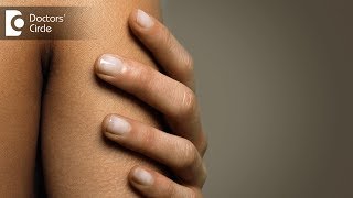 Causes and treatment of brownish fingernails - Dr. Amee Daxini