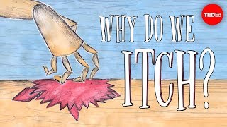 Why do we itch? - Emma Bryce