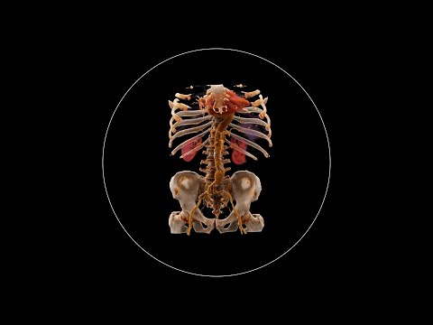 What is tomography used for?