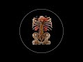 What is Computed Tomography (CT) and how does it work?