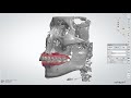 How to overlap of bone data