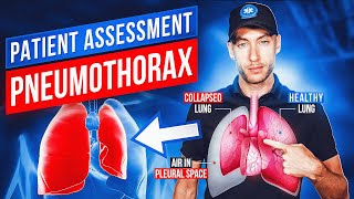 Patient Assessment Trauma | Tension Pneumothorax | EMT Skills | NREMT Review