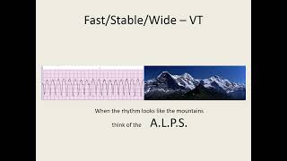 ACLS 2020 Algorithm Tachycardia