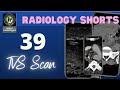 RADIOLOGYSHORTS 39 || NO BAKBAK VIDEOS || 3D TVS PELVIC SCAN