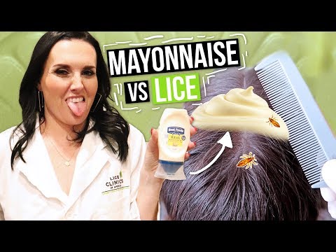 Does Mayo actually kill lice?