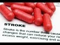 How to prevent stroke